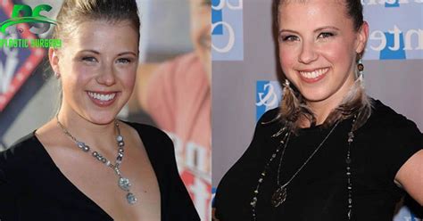 jodie sweetin boobs|Jodie Sweetins plastic surgery thoughts